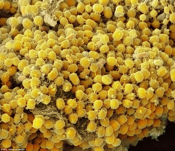 باکتری های زرد رنگ در لثه انسان 
