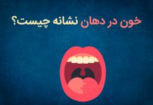 علت طعم و بوی خون در دهان
