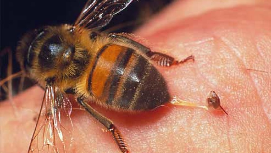 درمان نیش زنبور و گزیدگی با روش های خانگی