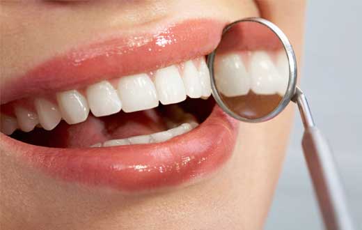 آیا دندان حساس به ترشیجات، گرما و سرما عصب کشی می خواهد؟