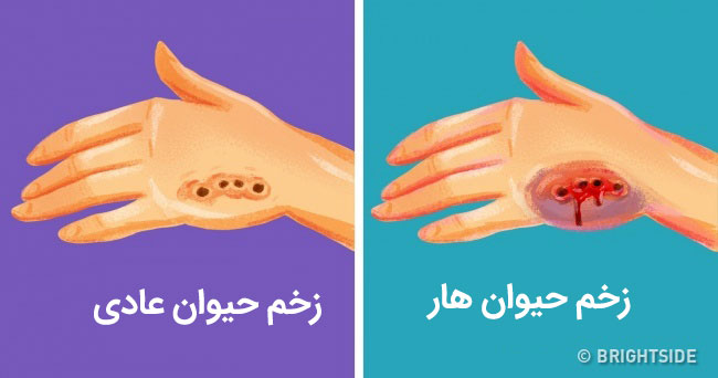 گاز گرفتگی حیوان هار