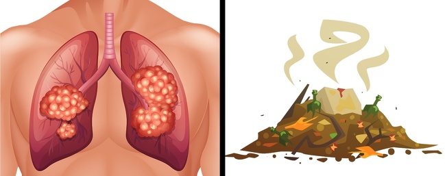 سرطان ریه - بوی پوسیدگی
