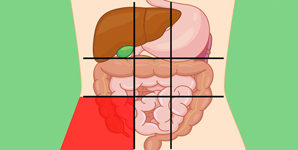 علت درد در قسمت پایین و سمت راست شکم