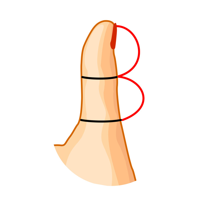 شکل انگشت شست نوع 1 : هر دو بند انگشت یکسان هستند