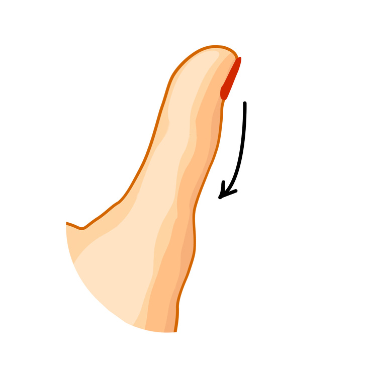 شکل انگشت شست نوع 5 : انگشت شست صاف است