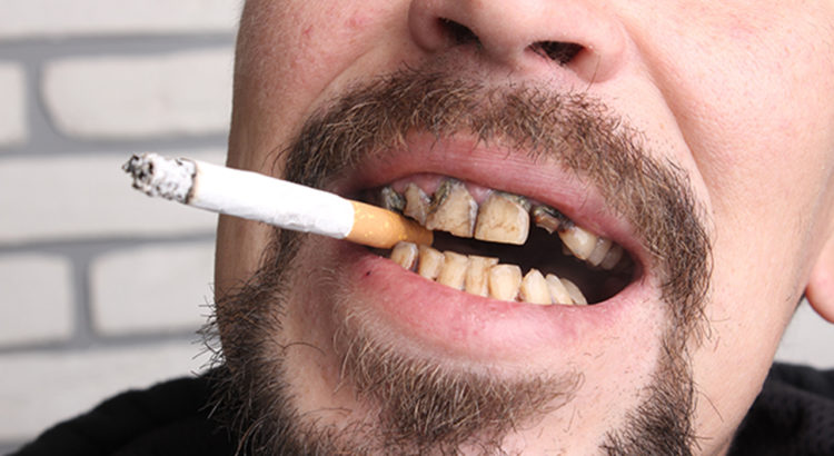 از بین بردن بوی بد دهان ناشی از سیگار کشیدن