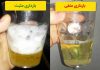 تست بارداری با نمک تصویری