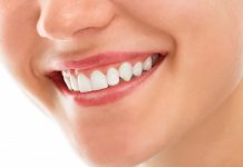 درمان لکه های قهوه ای رنگ دندان